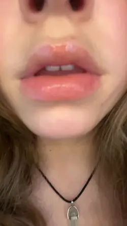 🎀