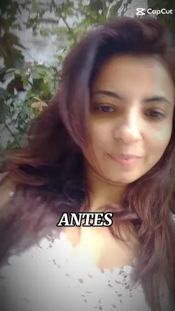 Antes e depois 