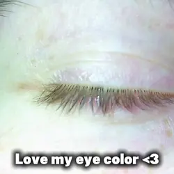 Eye color