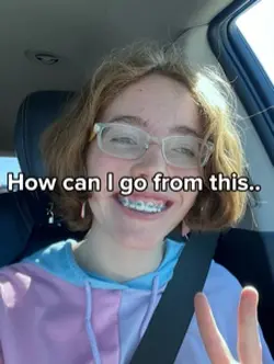 I got braces.. 