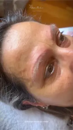 Brows Removal
