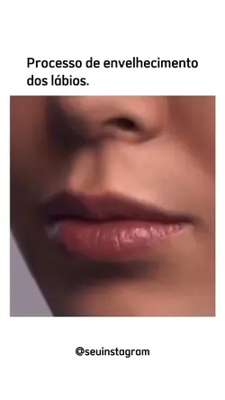 Estética | Lábios