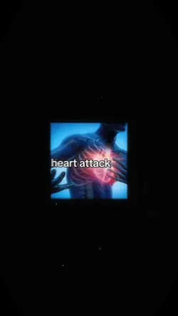Heart attack 