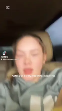 Wisdom teeth removal