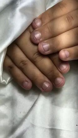Antes e depois 