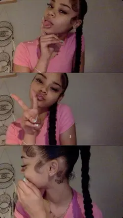 Kiss of life |