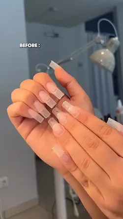 NAILS