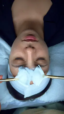 Facial