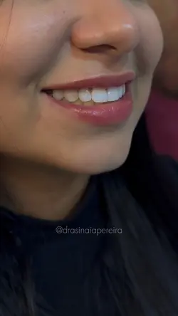 Antes e depois 