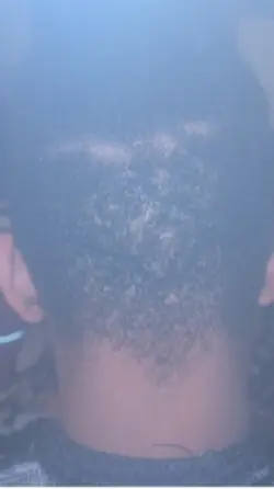 Bald fade