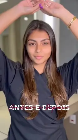 Antes e Depois