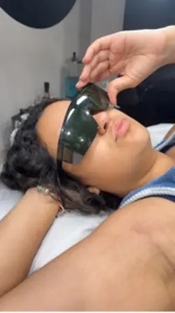 Laser Hair Removal