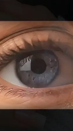 olho