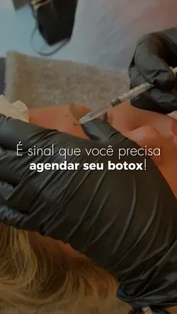 Divulgação botox