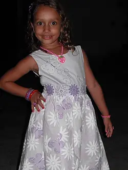 Antes X Depois 