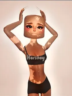 Gyaru/vitiligo