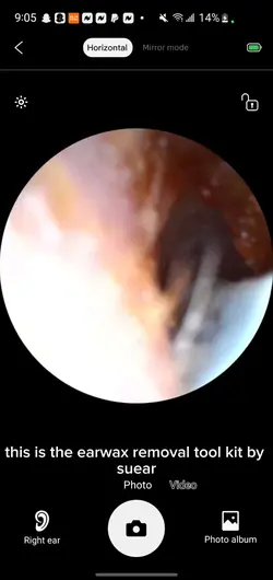 earwax removal kit