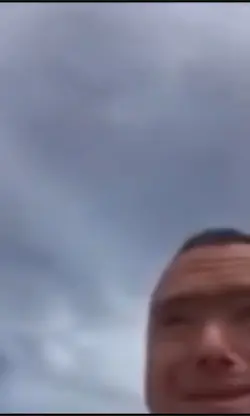 Down syndrome 