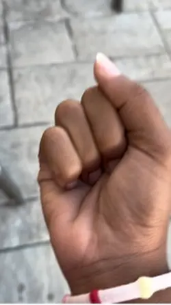 Only 4 fingers 