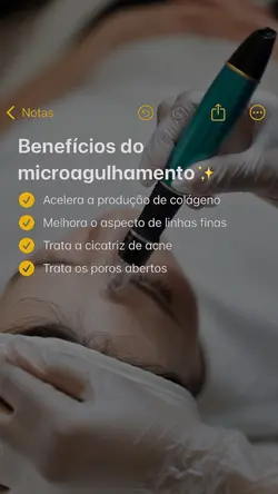 Microagulhamento 