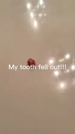 My tooth fell 