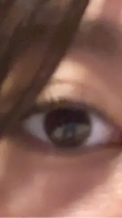 Eyes