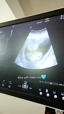 Mãe de menino 