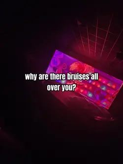 Why are there 