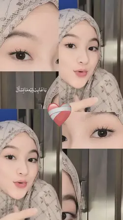 frame estetik