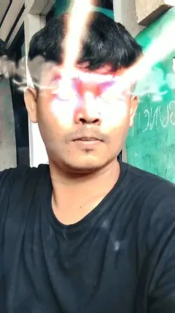 Matanya melotot