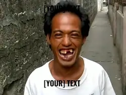 Totoy abnoy