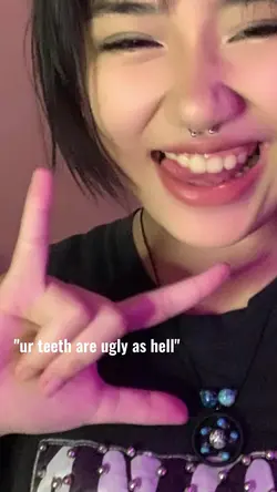 you teeth are ugly