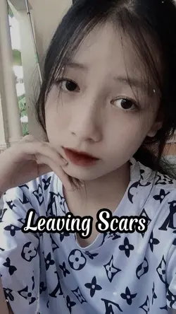Leaving Scars