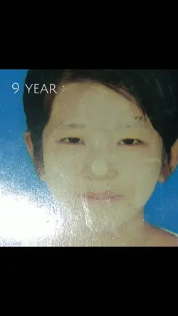 ငယ်ငယ်ကလူသက်မဲ့ရုပ်