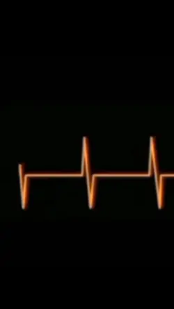 heartbeat 