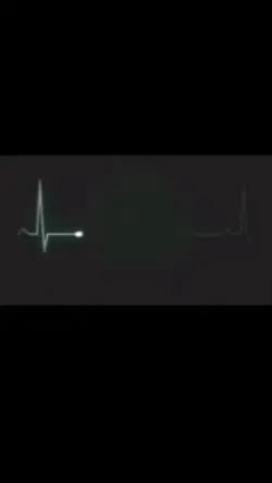 Detak jantung viral