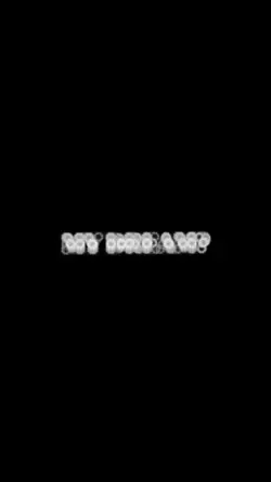 MY DREAM?