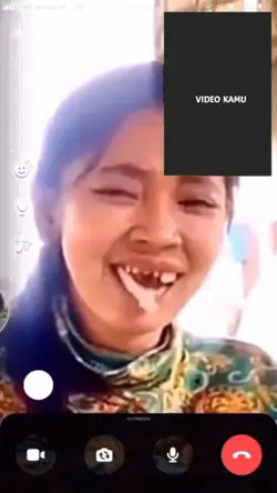 Gigi nya copot