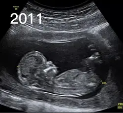 2011x2022