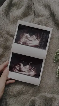 Pregnancy story