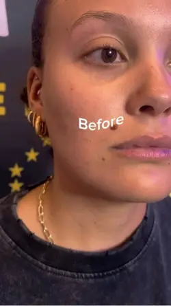 Before and after 