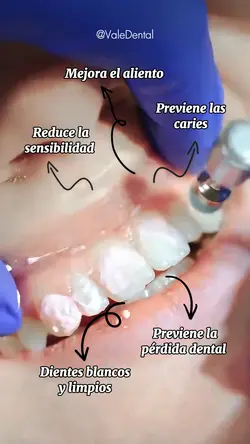LIMPIEZA DENTAL