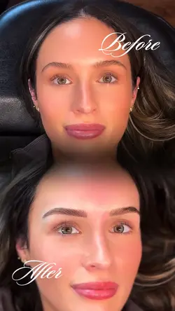 Before vs After 
