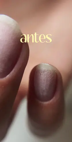 Antes y después
