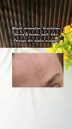 Review Moisturizer 