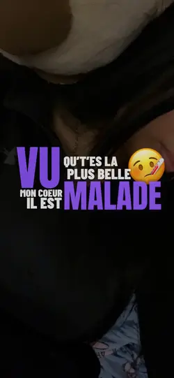 NAZA - Juste un 💋