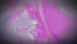 Free edit ig?