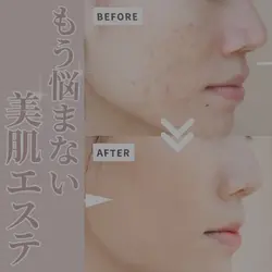 肌質改善