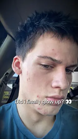Glow up