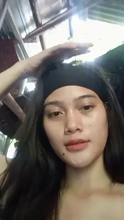 Rhinoplasty spoke